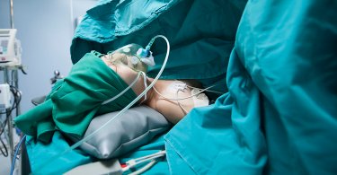 什麼是腹膜外剖腹產？與傳統剖腹產有何不同？