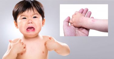 媽媽注意！定期補貨六種幼兒常備藥