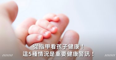 指甲,指甲月牙,指甲白點,甲溝炎,咬指甲