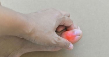 痛風,尿酸,尿酸過高,痛風症狀,腳踝痛,痛風石,手指關節痛,痛風飲食,手搖飲料,含糖飲料